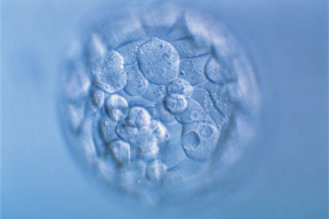 http://shenyang.quanwangkm.com/post/190.html|沈阳人工试管